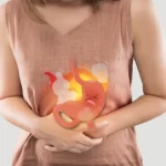 Natural Relief for Acidity and Digestion Problems