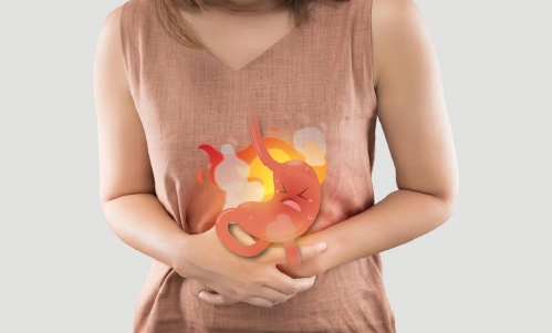 Natural Relief for Acidity and Digestion Problems